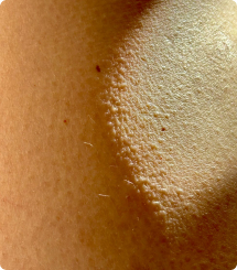 Giải pháp da nhạy cảm